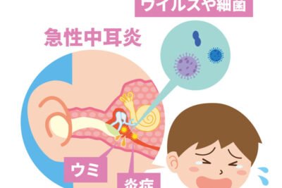 「耳ガサガサ音の原因と対処方法！」
